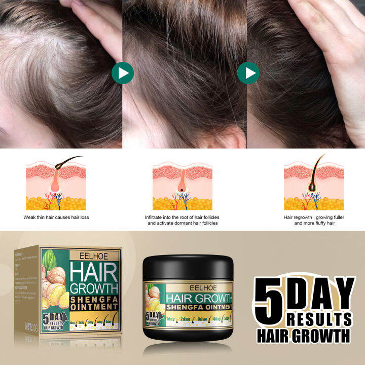 Eelhoe 5 Days Ginger Hair Growth Care Ointment 30g Hair Fast Regrowth