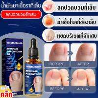 Removal paronychia oil น้ำมันฆ่าเชื้อราที่เล็บลดปวดบวมอักเสบ