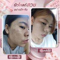 อาหารเสริมผิวสว่างกระจ่างใส แบบซอฟเจล ขนาด 1 ขวด มี 20 ซอฟเจล Bunch Rose Collagen บลั้นซ์ โรเซ่ อาหารเสริมบำรุงผิว