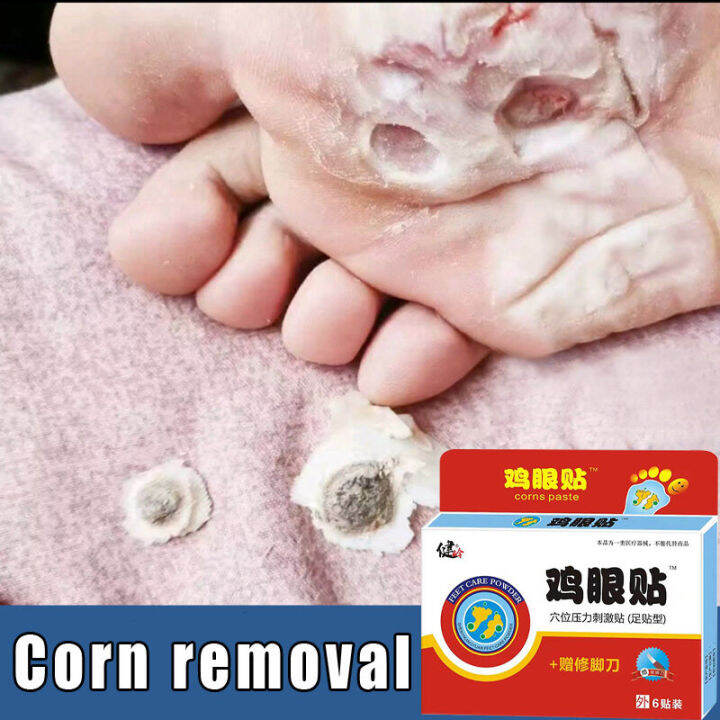 Foot Corn Removal Foot Patch Corn removal patches 6 patches/box Warts