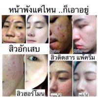 ⚡Flash sale ⚡แท้!?% ครีม WinkFace จากเจ้าของแบรนด์  หน้าวิ้งค์ (FaceWink) หน้ากระจ่างใส หน้าฉ่ำวาว (NEW!! รุ่นใหม่)