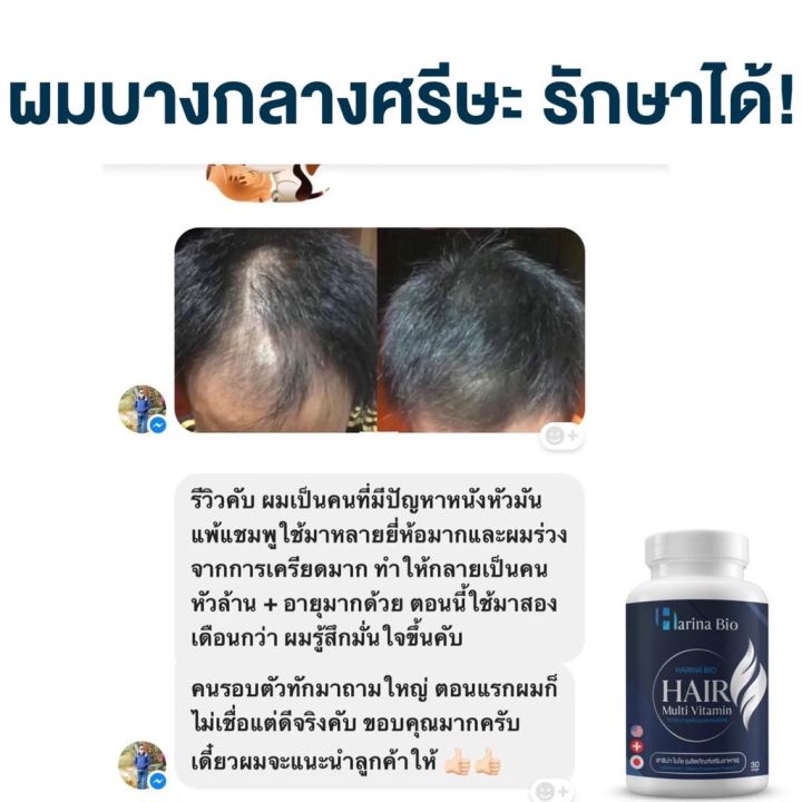 harina-bio-วิตามินบำรุงผมสูตรเภสัช-ลดผมร่วง-เพิ่มผมหนา-ชะลอการเกิดหงอก-มีวิตามินรวม-12-ชนิด