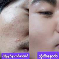 VACHI မ်က္ႏွာသစ္ 10 ခဲ 700 ဘတ္