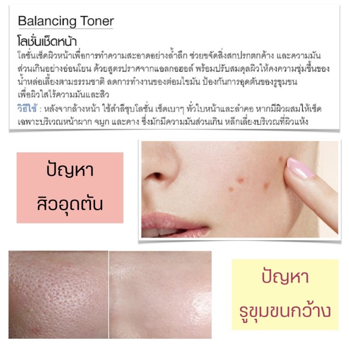 โทนเนอร์-โทนเนอร์เช็ดหน้า-โทนเนอร์หน้าใส-เวชสำอางค์-ให้ความชุ่มชื้นแก่ผิว-โทนเนอร์กิฟฟารีน-สิว-รูขุมขน-โลชั่นเช็ดหน้า-balancing-toner-g