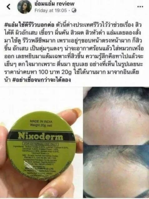 nixoderm-ครีมบรรเทาอาการสิวอักเสบ-สิวอุดตัน-สินค้าพร้อมส่ง