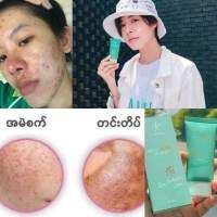 IAura SunScreen