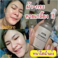 เซรั่มไฮยาวิตามินซี หน้าใสหน้าเด็ก 15 ml.