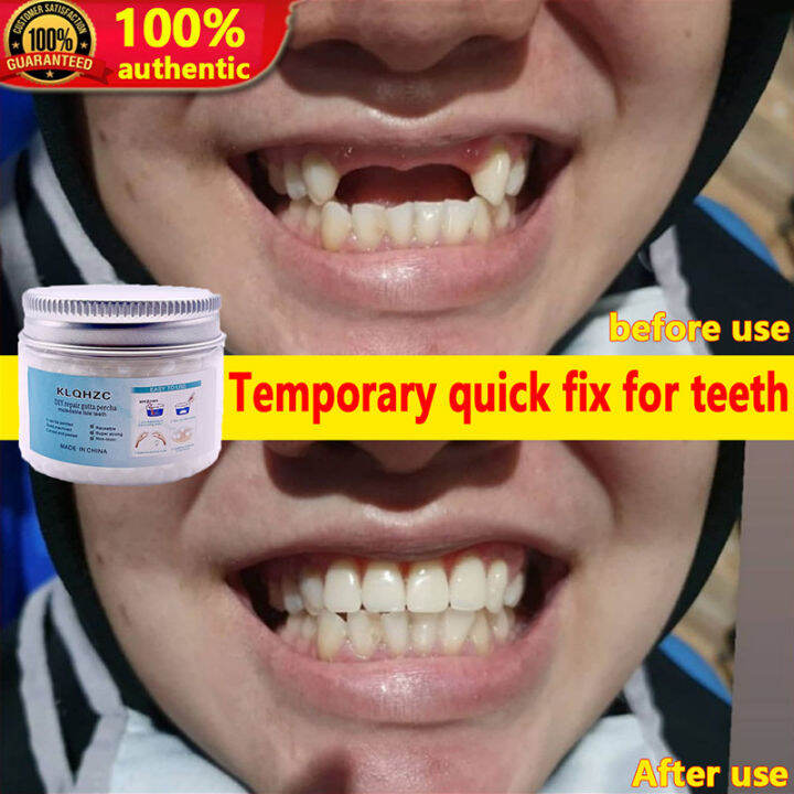 【1 second bonding】DIY Tooth Repair Kit Temporary Tooth Repair kit 50g