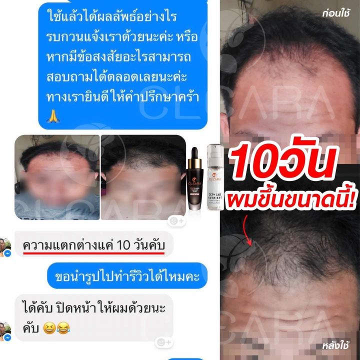 เคลียร์ร่า-เซรั่มปลูกผม-ลดปัญหาผมบางผมร่วง-เห็นผลชัด-100