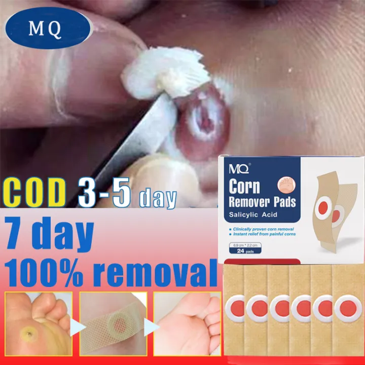 【24PCS/BOX】Warts Removal Patch Herbal painless safe removal natural