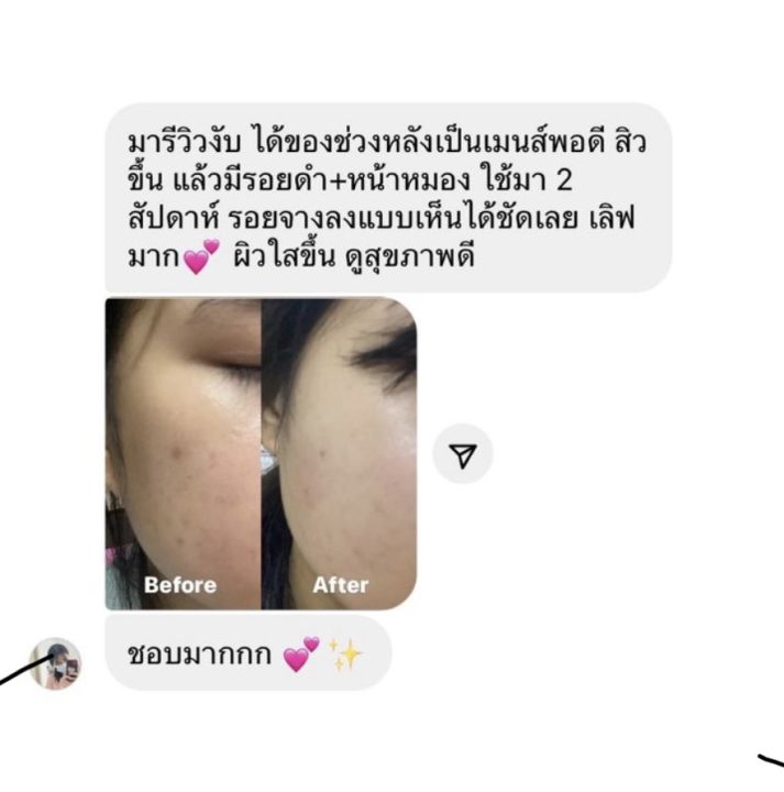 สบู่ลดสิว-หน้าขาวใสแบบธรรมชาติ