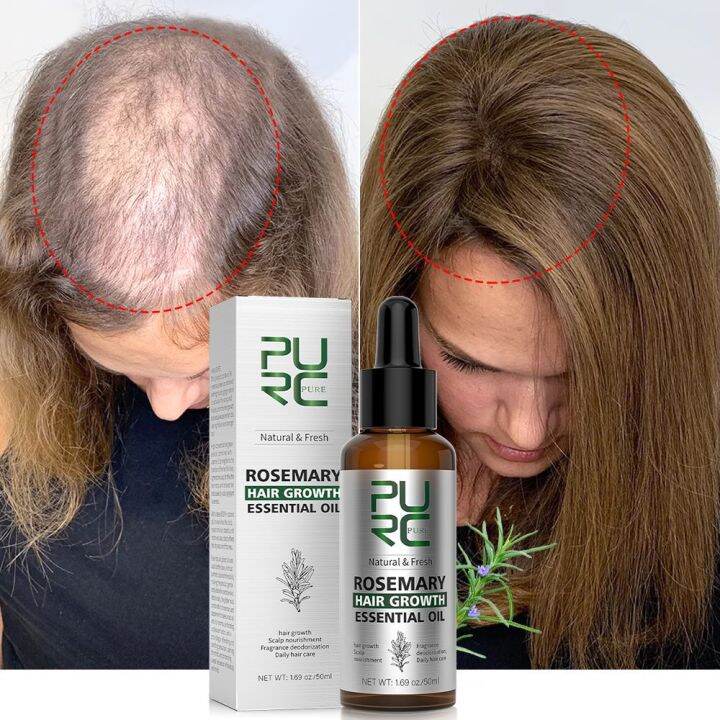 Purc Hair Growth Essential Oil Anti Hair Loss Fast Regrowth Essence Rosemary Oil Thinning Scalp 4736