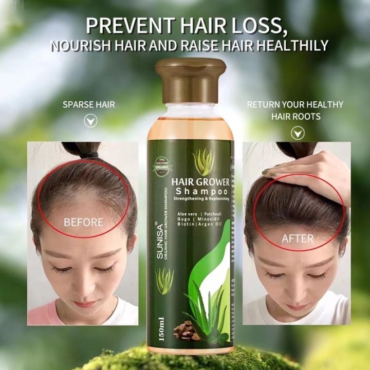 Extreme Sunisa Hair Grower Shampoo Minoxidil Gugo Aloe vera Argan Oil ...