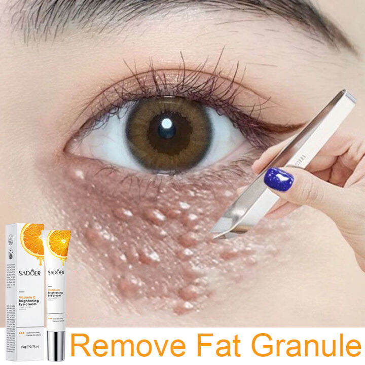 SADOER vitamin c eye cream eye bag remover dark circle eye serum Anti