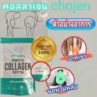 คอลลาเจนจากหนังวัว Chojen(โชเจน)คอลลาเจน 100% ขนาด 100 กรัม เลขที่อย. 11-2-00465-6-0001 (ส่งฟรี)