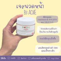 B 3 Acne gel 200ml