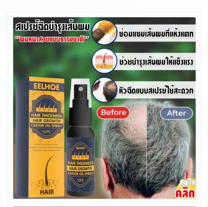 Hair growth castor oil spray สเปรย์ดูแลหนังศรีษะลดการหลุดล่วงของเส้นผม Lazada.co.th