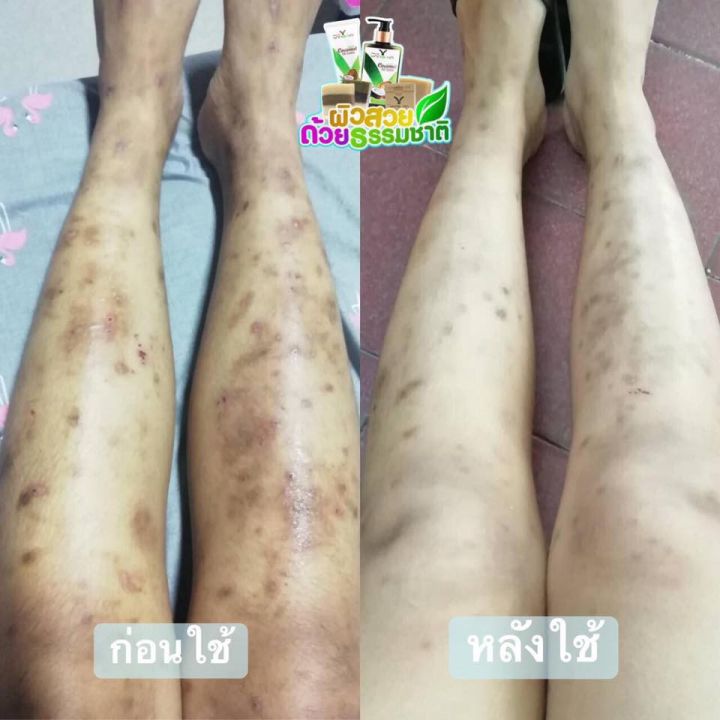 โลชั่นน้ำมันมะพร้าวสะกัดเย็น-โลชั่นยางนา