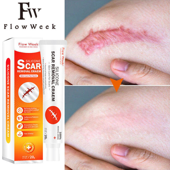 Scar Removal Cream Efficient Scar Remover for old scar on leg stretch