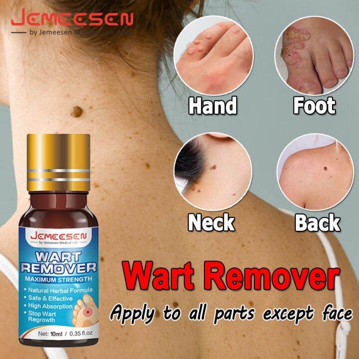 Jemeesen Wart Remover Wart Treatment Painless Mole Skin Dark Spot Warts ...