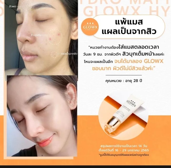 พร้อมส่งglowx-โกรว์เอ็กซ์เจลครีม-บำรุงผิวหน้าชุ่ทชื่น-สว่างใส-ลดฝ้า-กระ-จุดด่างดำ