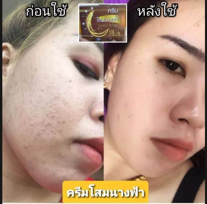 ครีมโสมนางฟ้า-kissing-ขนาด20กรัม-ของแท้-เก็บเงินปลายทาง