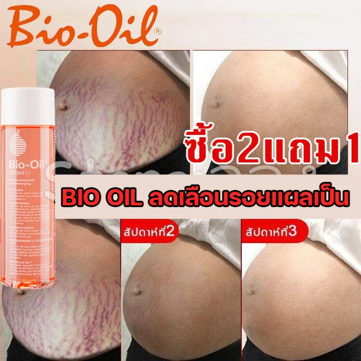 จัดส่งทันที ลดผิวแตกลาย แก้แตกลาย ให้ดูจางลง ปรับผิวให้สว่าง Body Oil ไบโอ ออยล์ 200 Ml ครีมทา