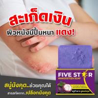 สบู่มังคุด 5 ดาว FIVE STAR จบทุกปัญหาโรคผิวหนัง