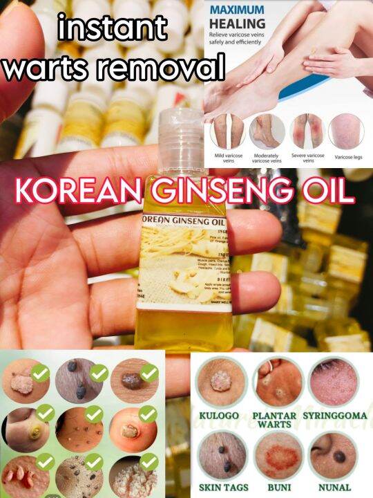 KOREAN GINSENG OIL 40ML WARYS REMOVAL VARICOSE VEINS PASMA LAMIG SA