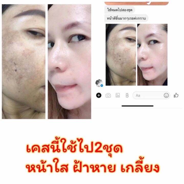 5ขวด-ส่งฟรี-เซรั่มมายา-เซรั่มโบท็อกซ์-เซรั่มโบท๊อก-เซรั่มโบท๊อค-maya-serum-ครีมมายา-ครีมบำรุงผิวหน้า-ครีมทา