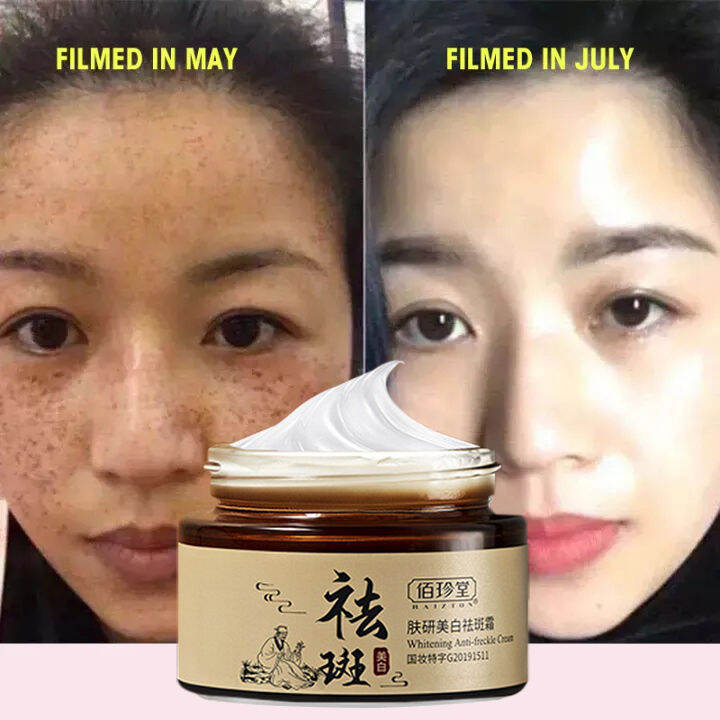 30g Whitening Cream Melasma Removal Dark Spot Remover Freckle Cream