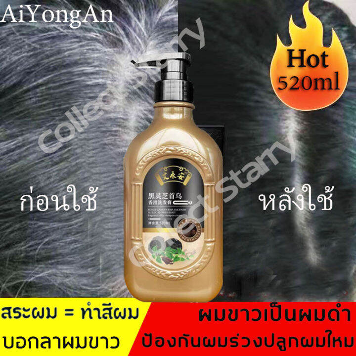 รักษาผมหงอก เหอโชวหวู่ เซรั่มแก้ผมขาว520ml สูตรสมุนไพร แก้ผมหงอก เป็นผม สีดำโดยธรรมชาติ บำรุงรากผม (แชมพูแก้ผมหงอก แชมพูสระผมดำ แชมพูสมุนไพร แก้ ผมหงอกถาวร แชมพูลดผมหงอก ยาสระผมแก้ผมหงอก แชมพูชายหญิง)He Shou Wu Shampoo | Lazada.co.th รักษาผมหงอก เหอโชวหวู่ เซรั่มแก้ผมขาว520Ml สูตรสมุนไพร แก้ผมหงอก เป็นผม สีดำโดยธรรมชาติ บำรุงรากผม (แชมพูแก้ผมหงอก แชมพูสระผมดำ แชมพูสมุนไพร แก้ ผมหงอกถาวร แชมพูลดผมหงอก ยาสระผมแก้ผมหงอก แชมพูชายหญิง)He Shou Wu Shampoo | Lazada.Co.Th