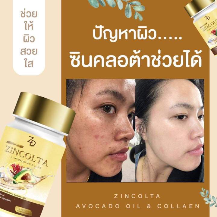 ซินคลอต้า-น้ำมันอะโวคาโด้สะกัดเย็นผสมคอลลาเจนญี่ปุ่น-1กระปุก-30เม็ด