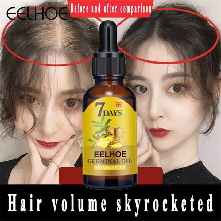 Eelhoe 7 Days Germinal Oil Ginger Regrowth Essence Anti Hair Loss ...