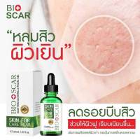 ไบโอสการ์  Bioscarไบโอสการ์ ลบแผลเป็น
ตุ่ม รอยสิว แผลเป็น น้ำเหลืองไม่ดี ผิวแพ้ง่ายใช้ได้ !!

ปรับผิวขาว เรียบเนียน ลบรอย 
เข่าดำ ศอกดำ คอดำ ต้องใช้
เซรั่มเข้มข้น เห็นผลไว 

หมายเลขใบอนุญาต/อย. 55-1-6500020182
วันหมดอายุ 15/2/2569