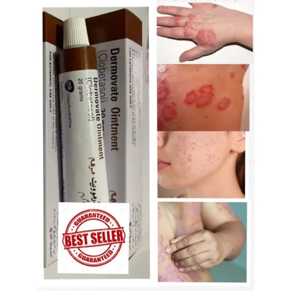 Clobetasol/ Ointment / Antifungal / Antibacterial / Skin Rashes | Lazada PH