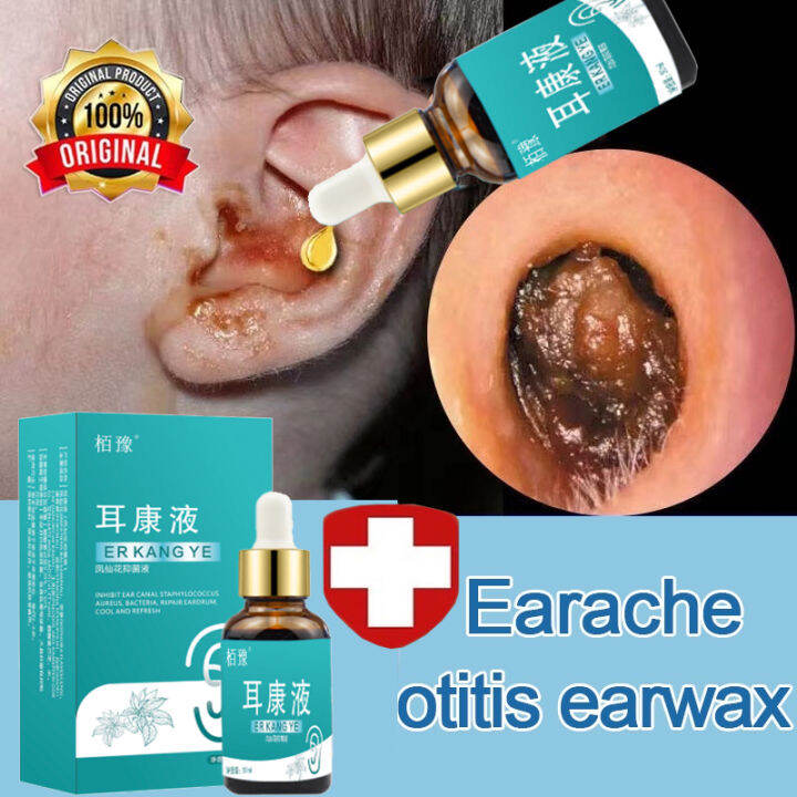 Otitis media ear drops Pus people use special medicine Earwax Cleanser