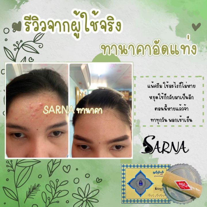 ส่งฟรี-แถมฟรีแปรงมาร์ก-ทานาคา-ทานาคาพร้อมหินฝน-ทานาคาแท้นำเข้าจากพม่า