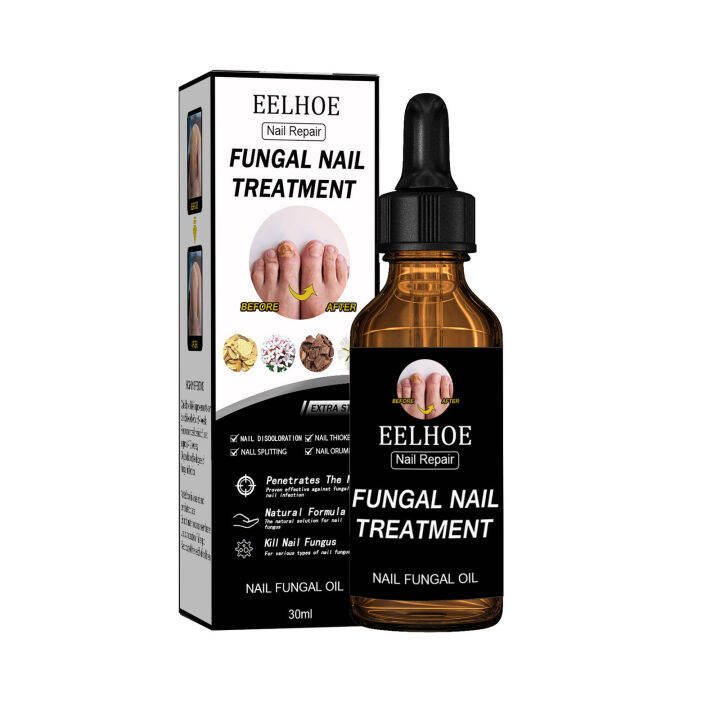 EELHOE Nail Repair Essence Toenail Fungus Treatment Liquids Paronychia