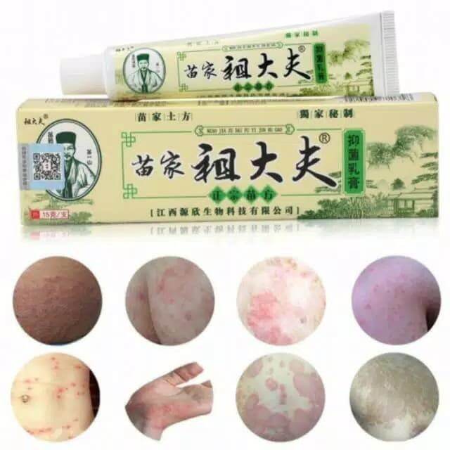 Ointment Itching Skin Fungus Eczema Chronic Medicine Ointment Skin ...