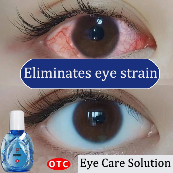 Eye Drops for Eye Care15ml/Brand Eye Drops/mineral eyedrops/Eye Drops ...