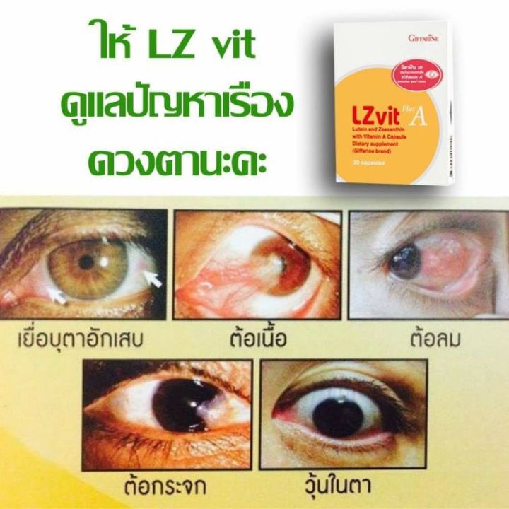 lz-vit-plus-a-giffarine-ลูทีน-บำรุงดวงตา-จอประสาทตา-กิฟฟารีน-ช่วยกรองแสงสีฟ้า-ปกป้องดวงตา-บำรุงสายตา-บำรุงดวงตา-30เม็ด