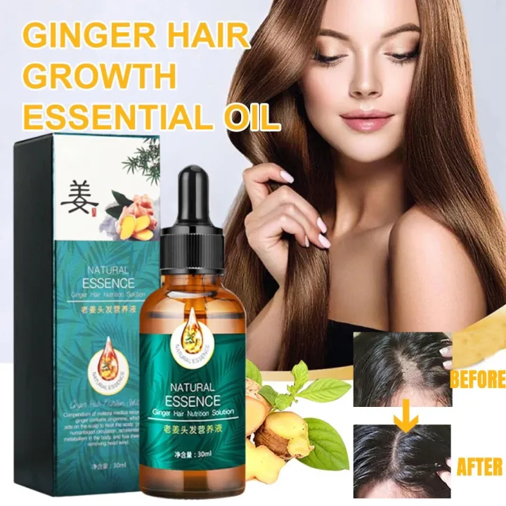 Minoxidil Fast Hair Growth Treatment Essence hair Serum Ginger Essential Anti Hair Loss SprayEssence | Lazada PH Minoxidil Fast Hair Growth Treatment Essence hair Serum Ginger Essential Anti Hair Loss SprayEssence | Lazada PH