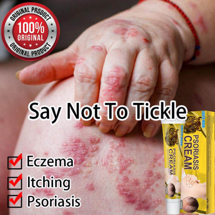 psoriasis treatment cream itchy skin relief cream 皮肤癣药膏 obat gatal
