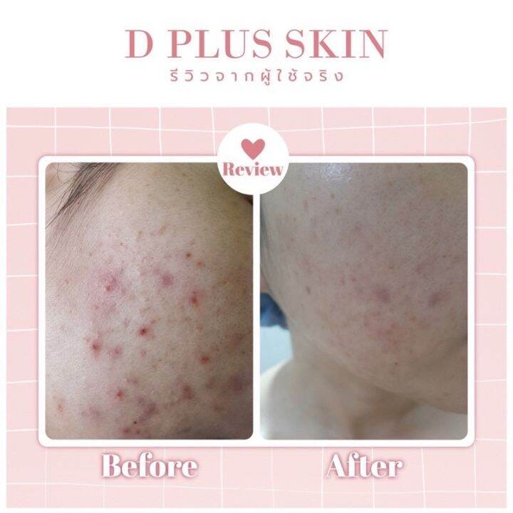 ของแท้-พร้อมส่ง-แกร๊ปคลอลาเจน-d-plus-skin-grab-collagen-คอลลาเจนผิวใส-grab-collagen-แก๊ปคอลลาเจน