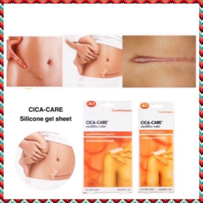 CICA CARE แผ่นซิลิโคน เจล ใส ซิก้าแคร์ ลดรอยแผลเป็น Silicone gel sheet scar