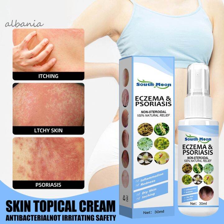 Eczema and psoriasis treatment spray for skin diseases antifungal, anti
