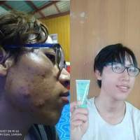 IAURA Gel နဲ႔ Suncream ရဲ့အားသာခ်က္ကဘာလဲဆိုရင္အမ်ားႀကီးလိမ္းလဲ လုံးဝျပာကြက္မသြားတာပဲ?

မိတ္ကပ္သားမပါလို့ ပြတ္ဆြဲရတာလဲ မခက္ဘူး ? 
လိမ္းတာမ်ားသြားရင္လည္းမျပာသြားဘူး.....?

Suncream ဆိုေတာ့ညဘက္
မလိမ္ရပါဘူးေနာ္ Gel ကေတာ့ဘယ္ခ်ိန္လိမ္းလိမ္းရ ?

Gel - 150-B