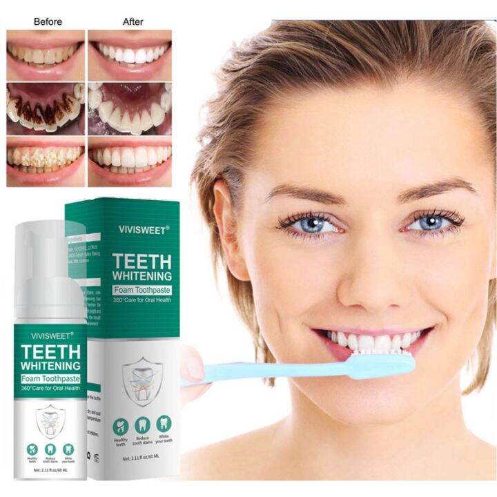 【SPRIFE】ALIVER Teeth Whitening hunmui Toothpaste Cleansing teeth Mousse ...