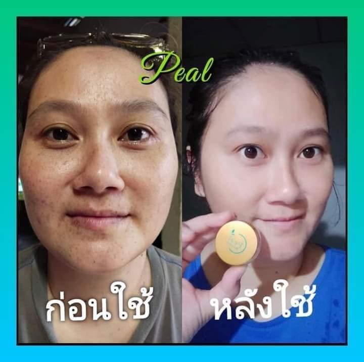 ครีมชาเขียวpeal-ครีมชาเขียว-รีกษาสิว-หน้าใส-ครีมชาเขียว-ฝ้ากะ-เห็นผลทุกสภาพผิว100-ของแท้100-peal-ครีมชาเขียว-ครีมไม่ตังแต่ครีมดี-รีกษาสิว-หน้าใส-ครีมชาเขียว-ฝ้ากะ-เห็นผลทุกสภาพผิว100-ข